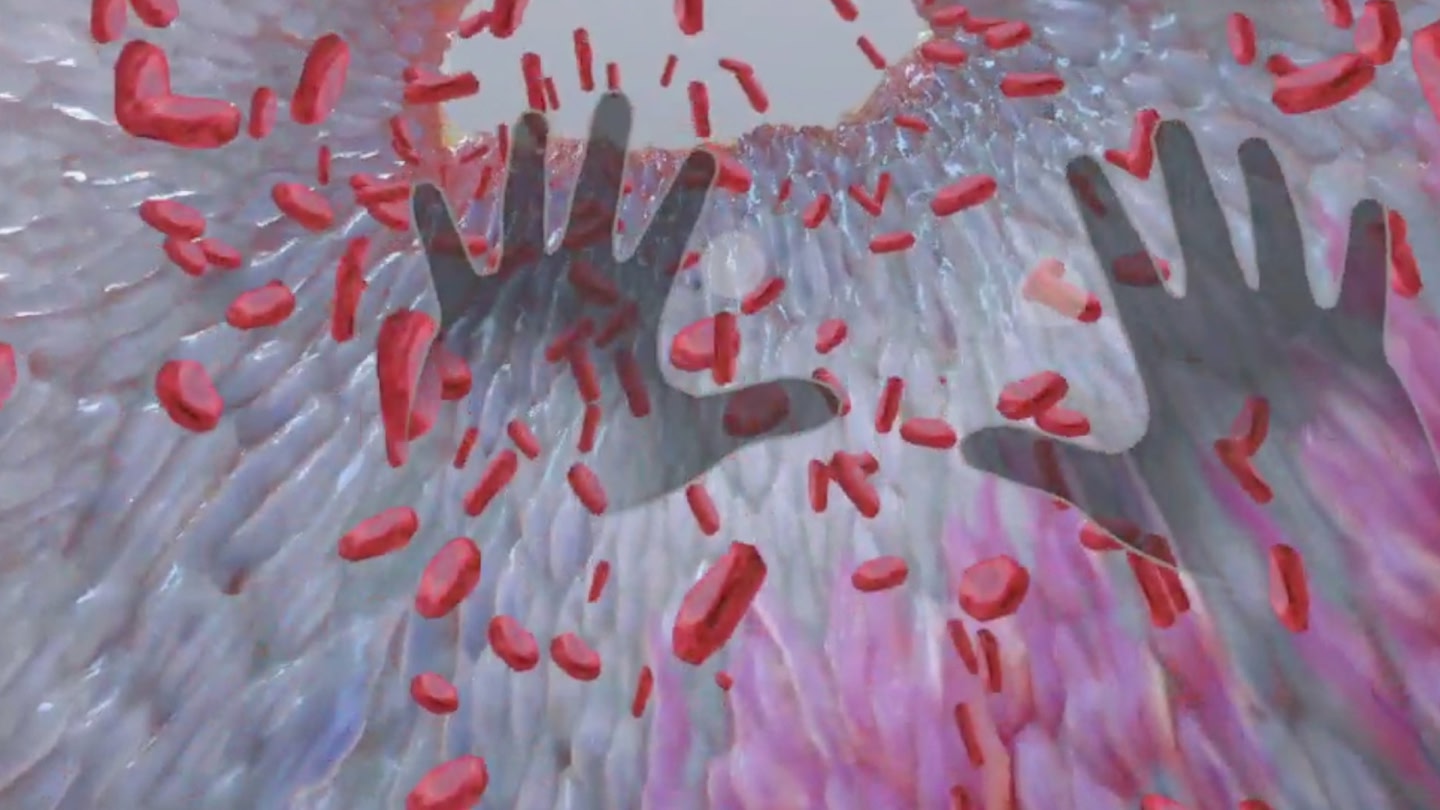 #6. Understanding Heart Attack (Meta) Door: XR Anatomy Ltd